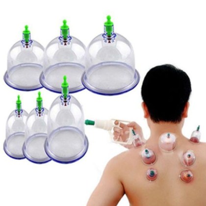 Ποτήρια Θεραπείας και Μασάζ 12 Τεμαχίων 